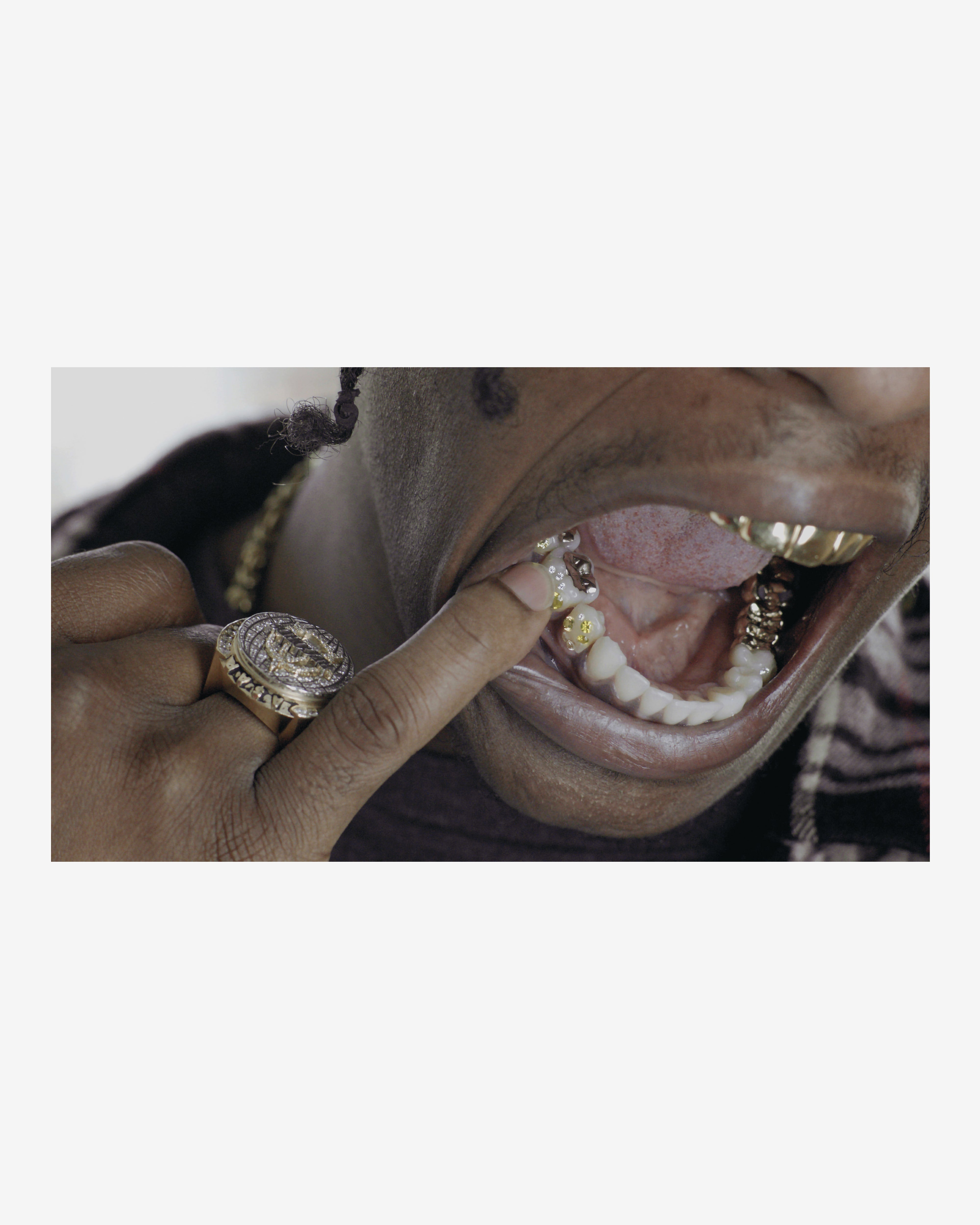 Idea: Mouth Full Of Golds (Re)Edition | DSMNY E-SHOP