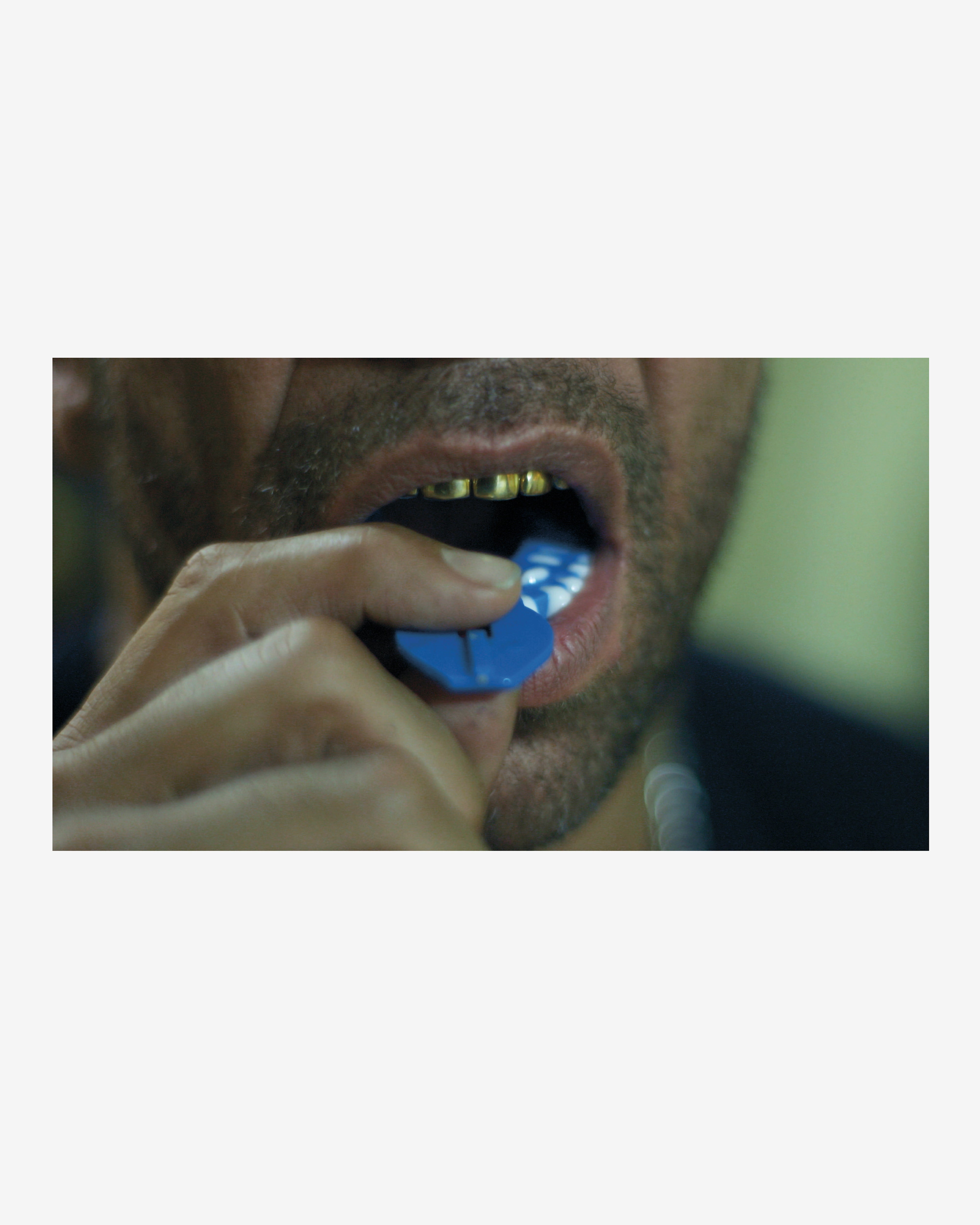 Idea: Mouth Full Of Golds (Re)Edition | DSMNY E-SHOP