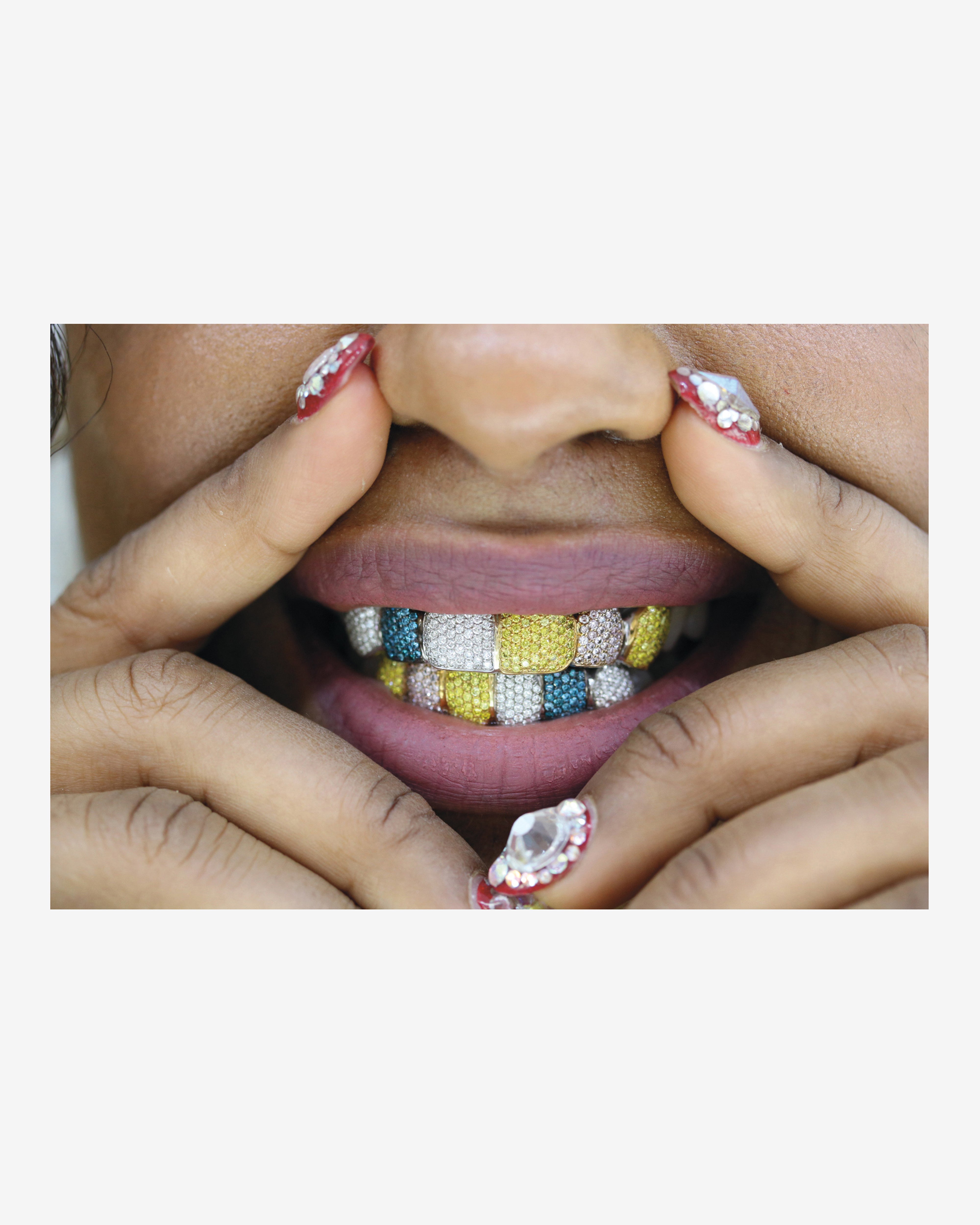 Idea: Mouth Full Of Golds (Re)Edition | DSMNY E-SHOP